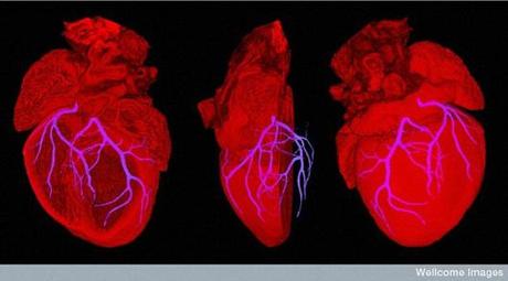 B0007341 Mouse heart showing position of coronary arteries