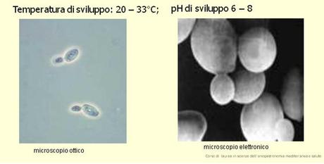 Saccharomyces cerevisiae 