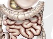 Come risolvere problemi intestinali punti chiave)