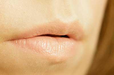 Herpes labiale, il nemico numero uno degli appuntamenti galanti