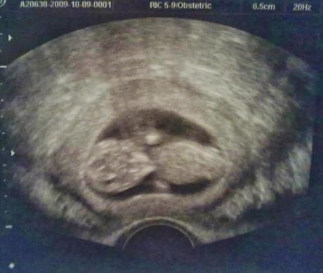 Ritratto di Signora #30: special edition 8 Marzo