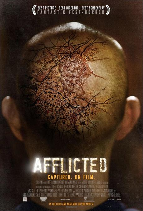 Terrificante quanto geniale ecco il full trailer di Afflicted