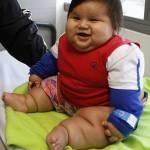 Santiago, il bimbo colombiano che a 8 mesi pesa 20 chili01