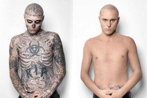 Rick Genest