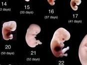 Embrioni umani