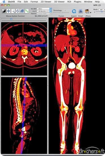 osirix-308887-1259814529