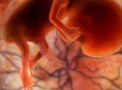 Medico abortista: feto umano? Come condannato morte»