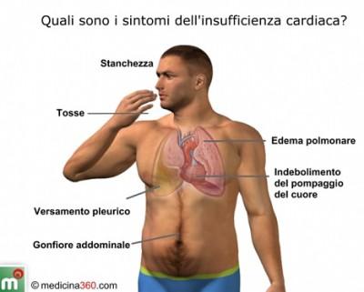 sintomi-insufficienza-cardiaca