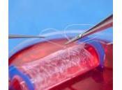 Vagina sintetica creata laboratorio impiantata ragazze
