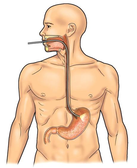 Click Salute n.30 - L'endoscopia digestiva - Figura 1