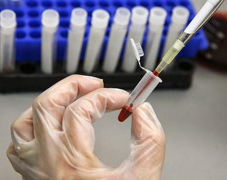 Death Test - l'esame del sangue per scoprire se morirete entro 5 anni