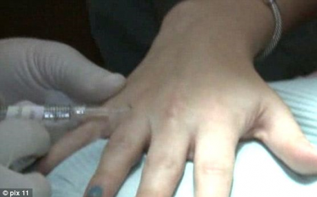 Chirurgia estetica al dito per... selfie perfetto con anello: ultima follia USA