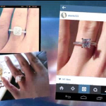 Chirurgia estetica al dito per… selfie perfetto con anello: ultima follia USA