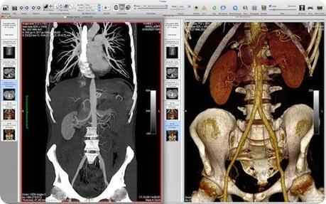 osirix-mri-dcm-viewer