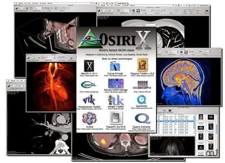 osirix1