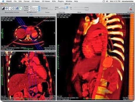 osirix-12