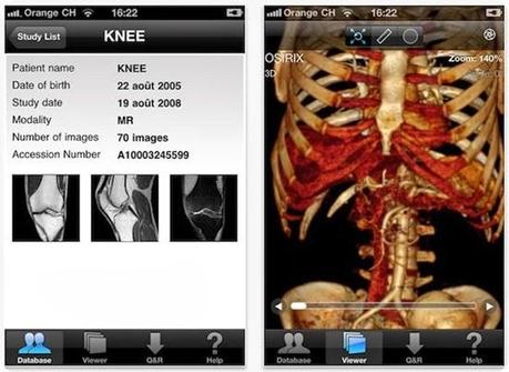 osirix-for-iphone