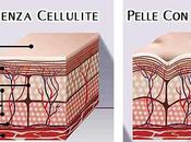 cellulite esiste…