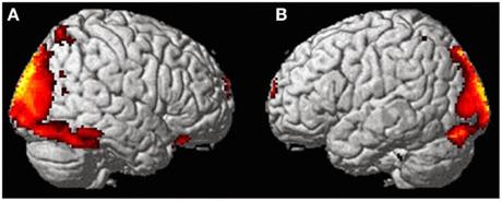 Scienziati scansionano il Cervello di una Donna durante un Esperienza Fuori dal Corpo