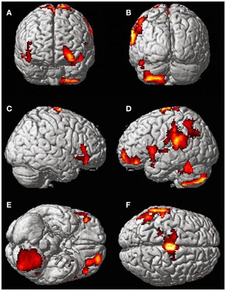 Scienziati scansionano il Cervello di una Donna durante un Esperienza Fuori dal Corpo