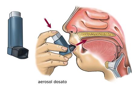 Somministrazione dei farmaci per via inalatoria