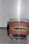 Teeth_in_Glass_jpg