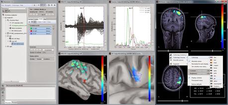 Brainstorm per visualizzare “tempeste cerebrali”