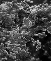 Scoperto il peptide che distrugge il biofilm dei batteri