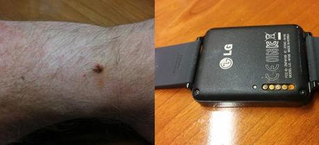 LG G Watch sembra essere soggetto a problemi di corrosione