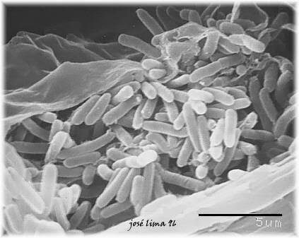 Xylella fastidiosa subspecie pauca fa parte dei batteri fastidiosi