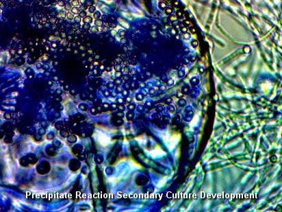Lo scienziato Clifford Carnicom individua una nuova specie di esseri viventi: i cross domain bacteria Lo scienziato Clifford Carnicom individua una nuova specie di esseri viventi: i cross domain bacteria