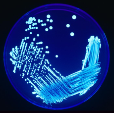 Legionella