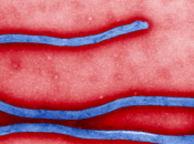 Ebola, copertura della medicina moderna
