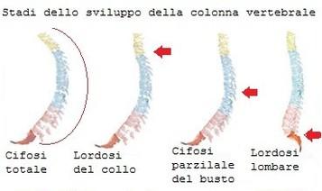 Portare verticalmente: la colonna vertebrale assume una posizione corretta?