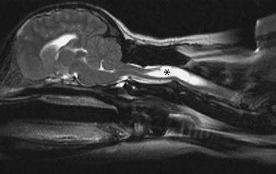 SIRINGOMIELIA NEL CANE:UNA MALATTIA EMERGENTE