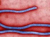 Primo caso Ebola diagnosticata nell’UE