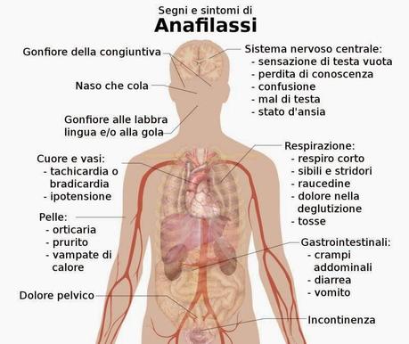 Maria Grazia, le allergie e la dieta(con video del Dottor Mozzi)