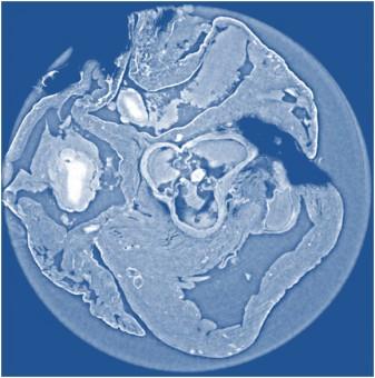 Immagine ottenuta in modo non invasivo della sezione del tessuto cardiaco di un topo realizzata la tomografia X a contrasto di fase propagation-based, tecnica che fornisce immagini più nitide e con una risoluzione superiore rispetto alle altre due tecniche considerate nello studio. Crediti: Irene Zanette/Technische Universität München