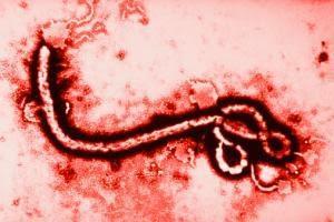 VIRUS EBOLA, MADE IN USA? VIRUS EBOLA, MADE IN USA?