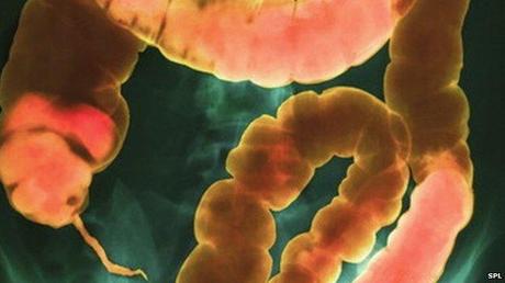 il giornale di furbanzio - Come determinare il proprio microbioma intestinale