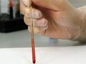 Endometriosi: esame sangue diagnosticarla