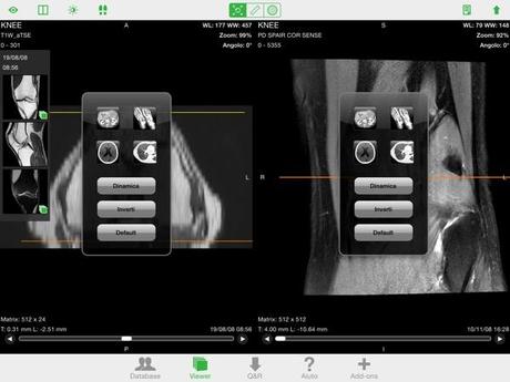 OsiriX HD DICOM PACS Viewer iPhone iPad recensione Mobimed 3