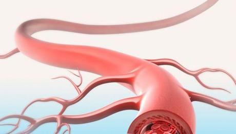 Primo vaso sanguigno artificiale, salvato bimbo di 4 anni