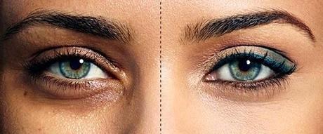 Contro le occhiaie i rimedi naturali