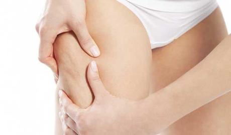 riduzione cellulite consigli utili 