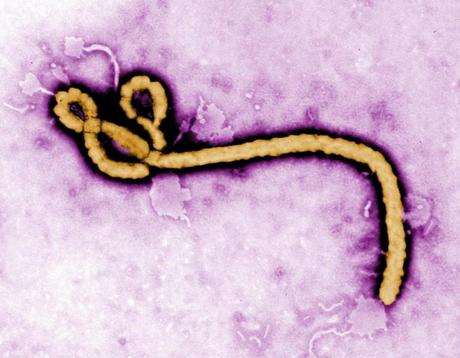 Ebola: diagnosticato un nuovo caso in Scozia