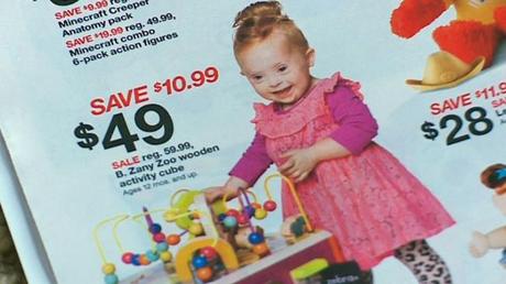 print-target-girl-down-syndrome