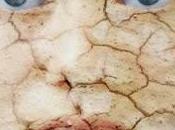 Come trattare pelle secca modo naturale