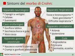 Antonio, il Morbo di Crohn e la dieta dei gs