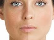 Dermamelan pura avanguargia!